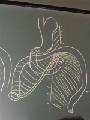 Abdomen - DSCN5826.jpg (464 ko)